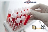 19.90€ γενικό αιματολογικό check up για γυναίκες και άνδρες, στο βιοπαθολογικό-μικροβιολογικό Εργαστήριο Αιμοδιάγνωση στην Νέα Κηφισιά.