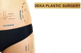 49€ Συνεδρία Cryolipolisis 3D ή 89€ Δυο Συνεδρίες Cryolipolisis 3D, στο Deka Plastic Surgery που βρίσκεται στο Σύνταγμα!! Για την αντιμετώπιση τοπικού πάχους, κυτταρίτιδας και χαλάρωσης. Η μείωση του αριθμού των λιποκυττάρων είναι μόνιμη!!
