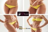Mε 59€ για 9 συνεδρίες σύγχρονων μηχανημάτων – 3 Cavitation, 3 Rf, 3 Vac και 2 Επισκέψεις για λιπομετρήσεις, με το επιτελείο επιστημόνων στο “Chic & Beauty Med Spa” στο Περιστέρι.